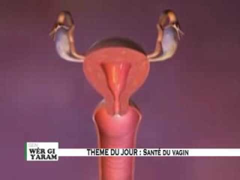 Sen wer gi yaram 310: Quelques secrets pour un vagin sain